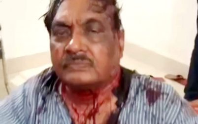 হামলায় রক্তাক্ত বরকত উল্লাহ বুলু, স্ত্রীসহ আহত ৬