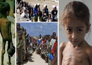 বিশ্বে দুর্ভিক্ষের ঝুঁকিতে প্রায় সাড়ে ৩৪ কোটি মানুষ 